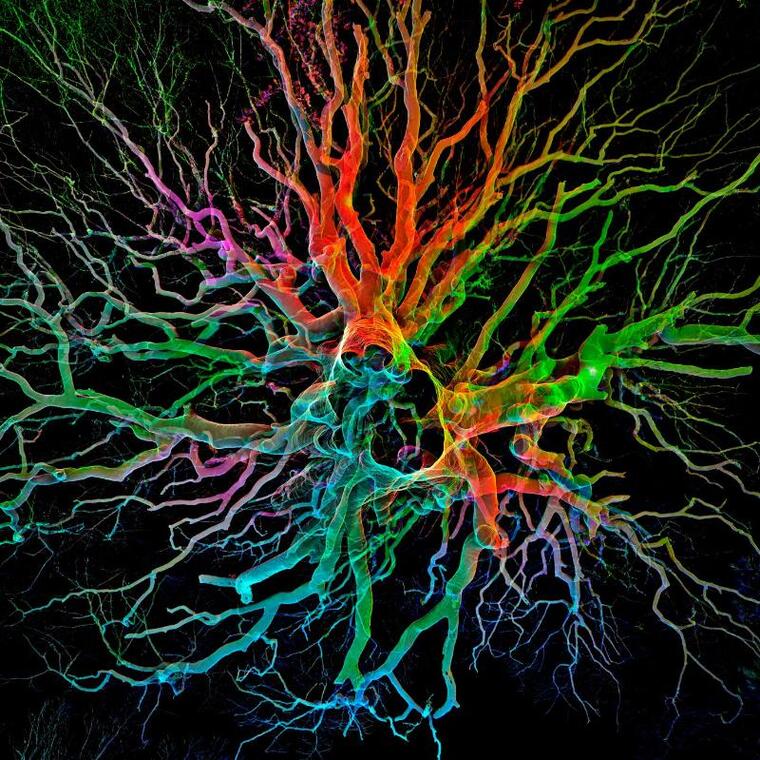 expo arbres remarquables en 3D ©Yan Koch