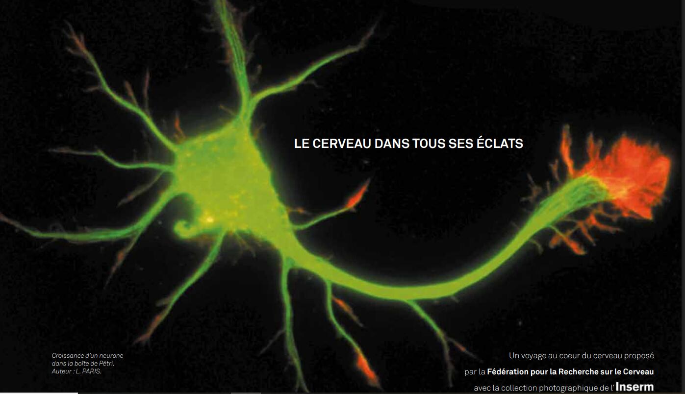 Exposition sur le Cerveau_Chabottes