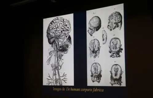 l-histoire-de-la-neurochirurgie-131749