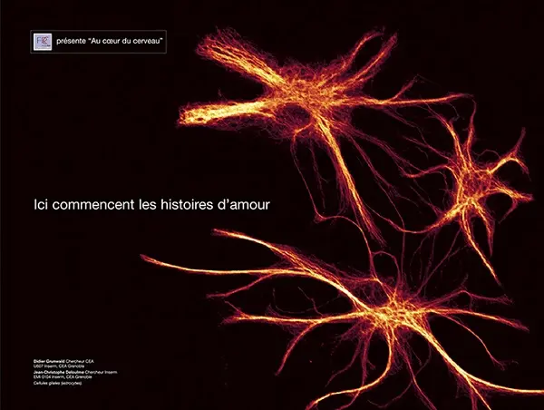 Expositionaucoeurducerveau