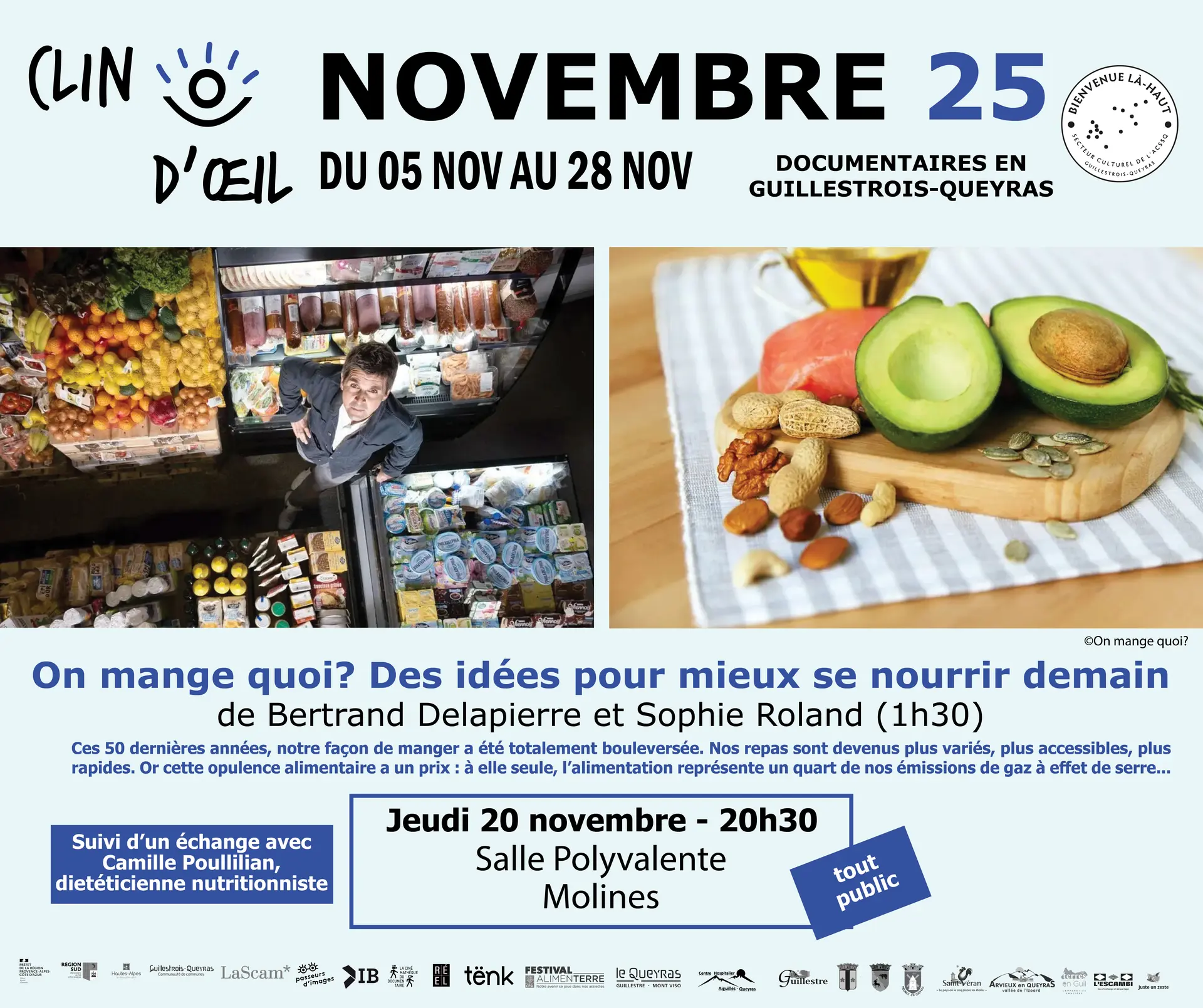 Clin d'oeil - On mange quoi ?