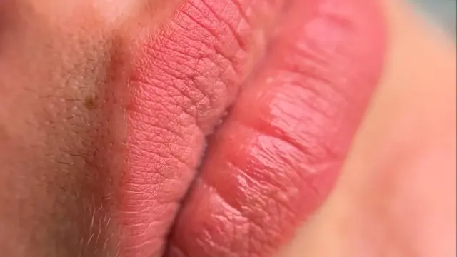 Retouche des lèvres après 6 semaines