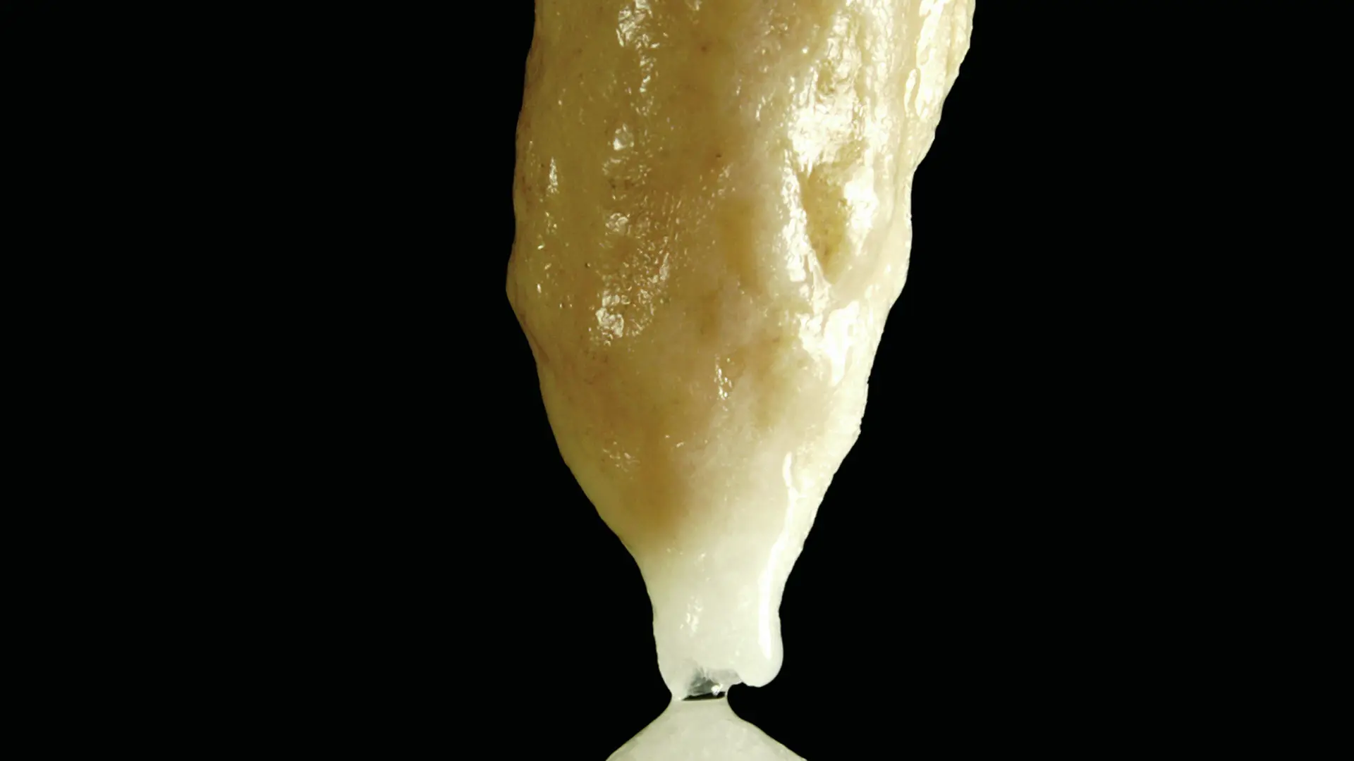 5©GC- Rencontres des siècle