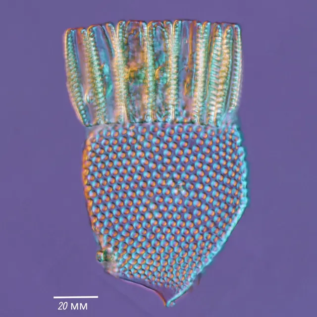 Squelette d'un radiolaire Challengeria balfouri.