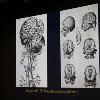 l-histoire-de-la-neurochirurgie-131749