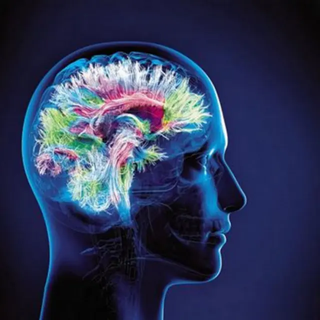 Conférence : Que se passe-t-il dans notre cerveau quand nous dormons, quand nous rêvons, méditons, sommes en hypnose, en transe ou dans le coma ?_Aix-en-Provence