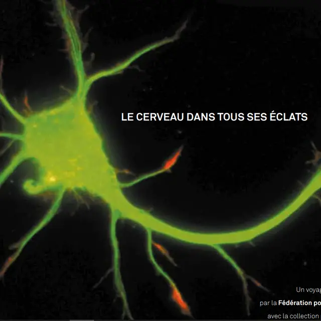 Conférence diaporama sur les neurones_Chabottes