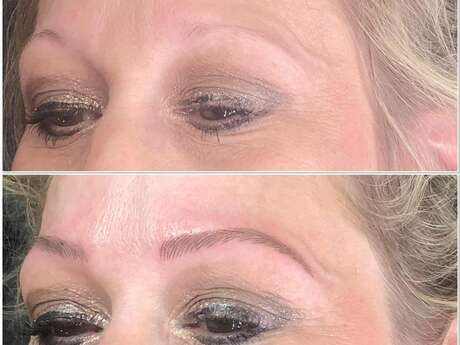 Marlène - Dermographe