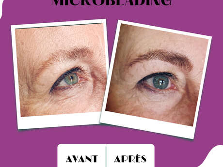 Microblading and laser hair removal Microblading and laser hair removal