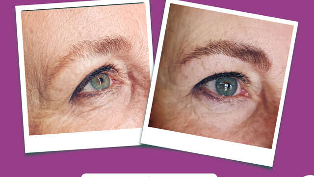 Microblading and laser hair removal