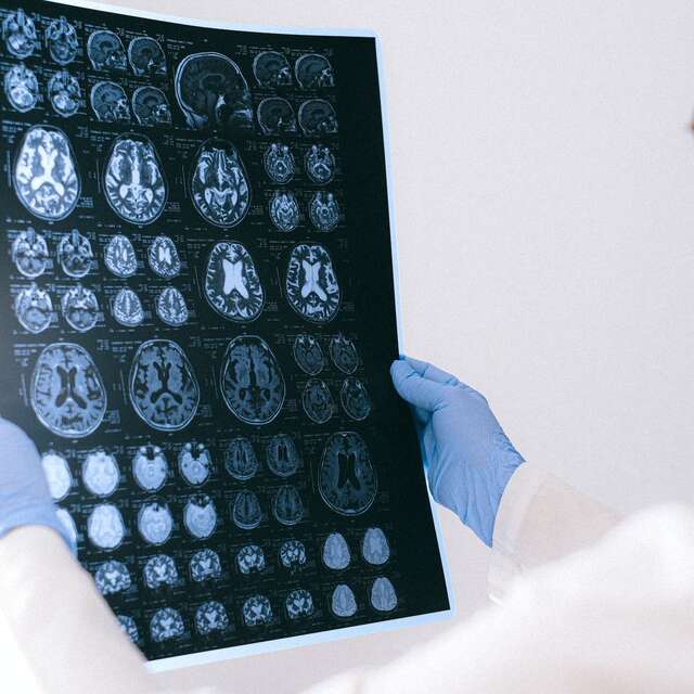 3ème édition des Entretiens Alzheimer Rouen - Fondation Recherche Alzheimer